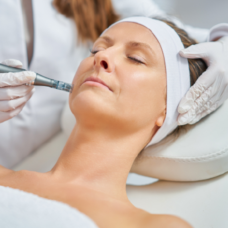 Microneedling Therapy Microneedling Therapy